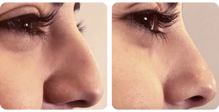 Before-After-01