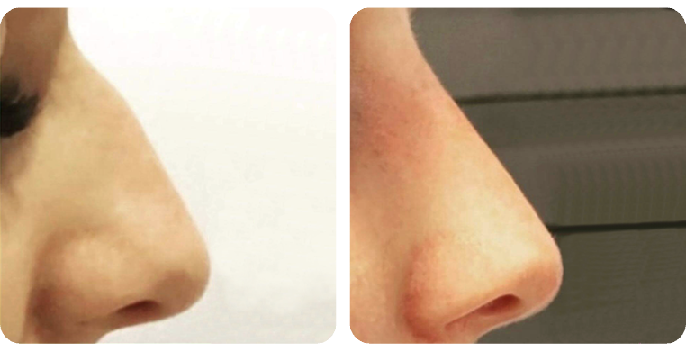 Before-After-02a