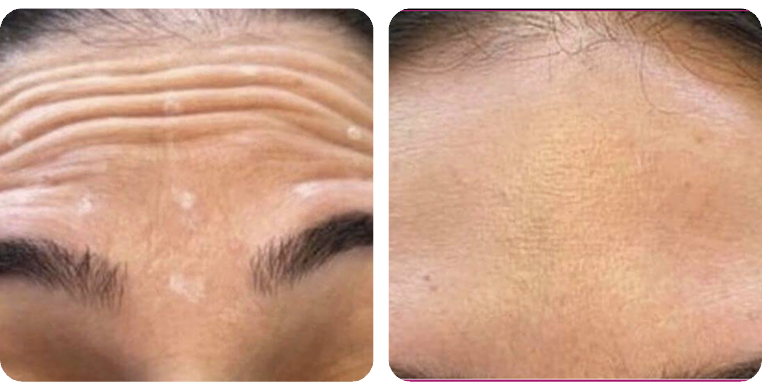 Before-After-03