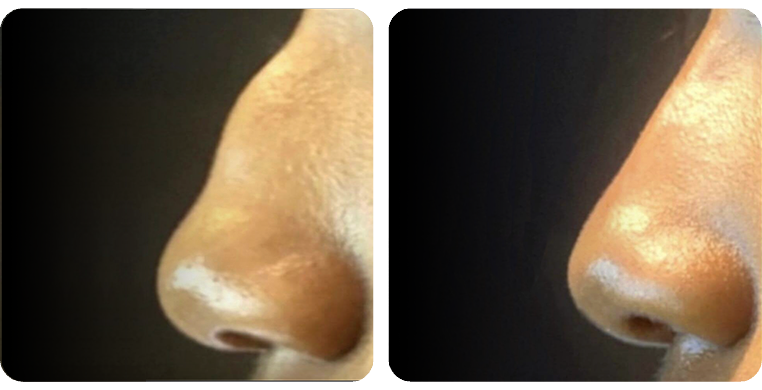 Before-After-04a
